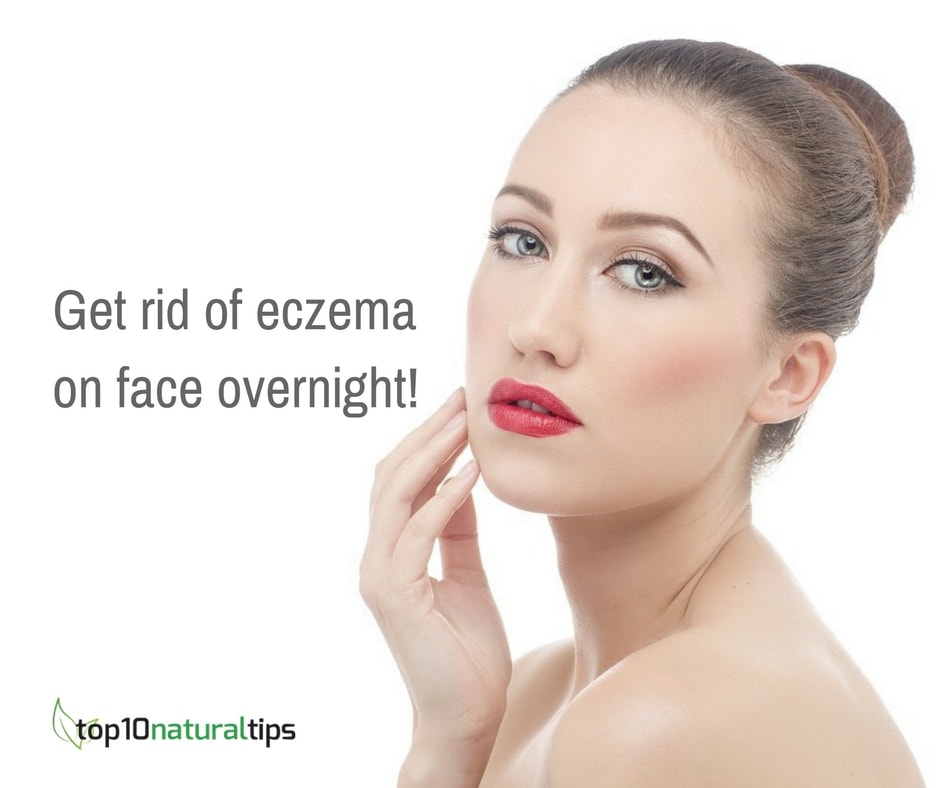 get rid of eczema on face overnight
