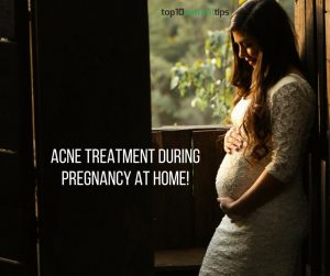 acne treatment during pregnancy