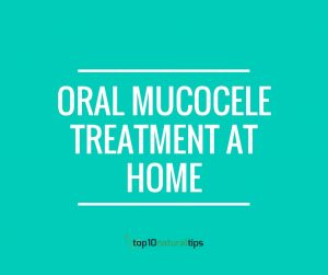 oral mucocele treatment at home