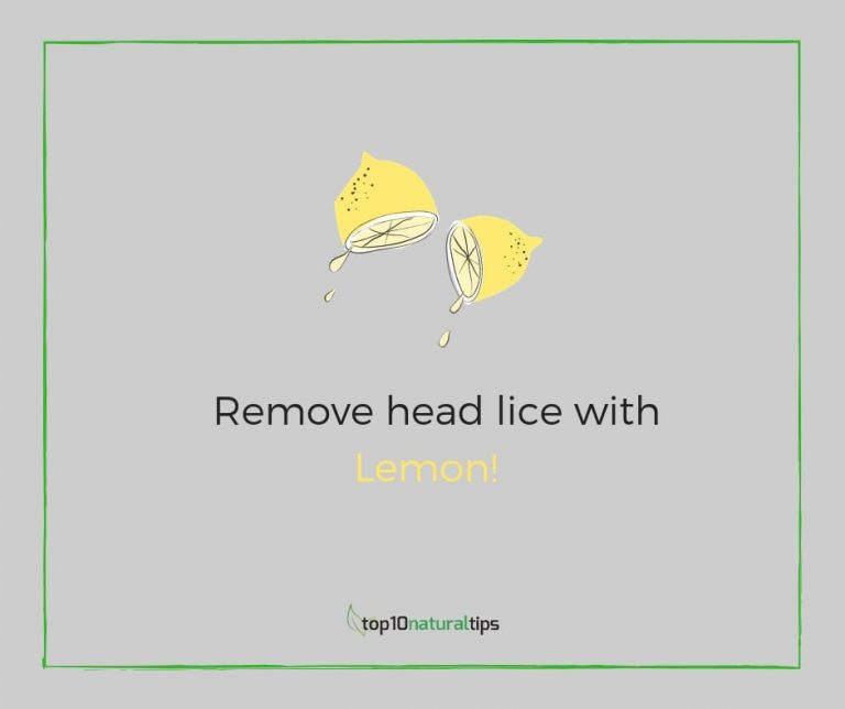 How to remove lice & nits from hair permanently in 1 day with LEMON