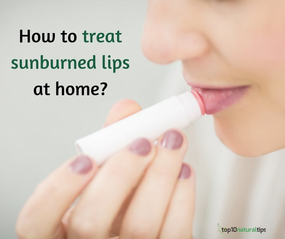 How to treat sunburn lips at  estate - fast remedy! - Top10  