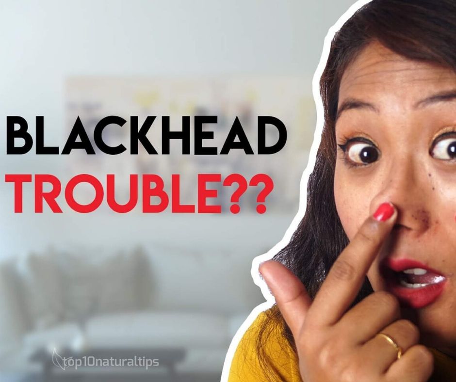get rid of blackhead on nose